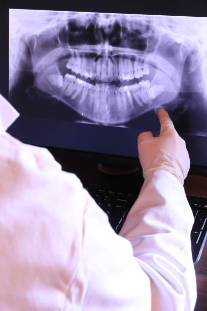 Best Broken or Chipped Tooth Repair in Spotswood, NJ