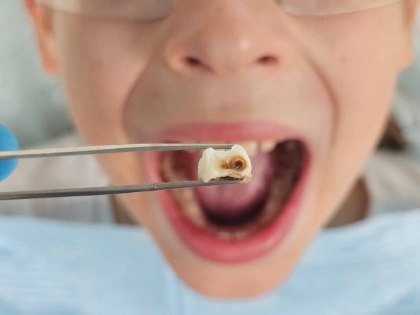 Best Emergency Care for Gum Disease in Spotswood, NJ