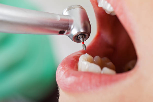 Best Emergency Root Canal Therapy in Spotswood, NJ